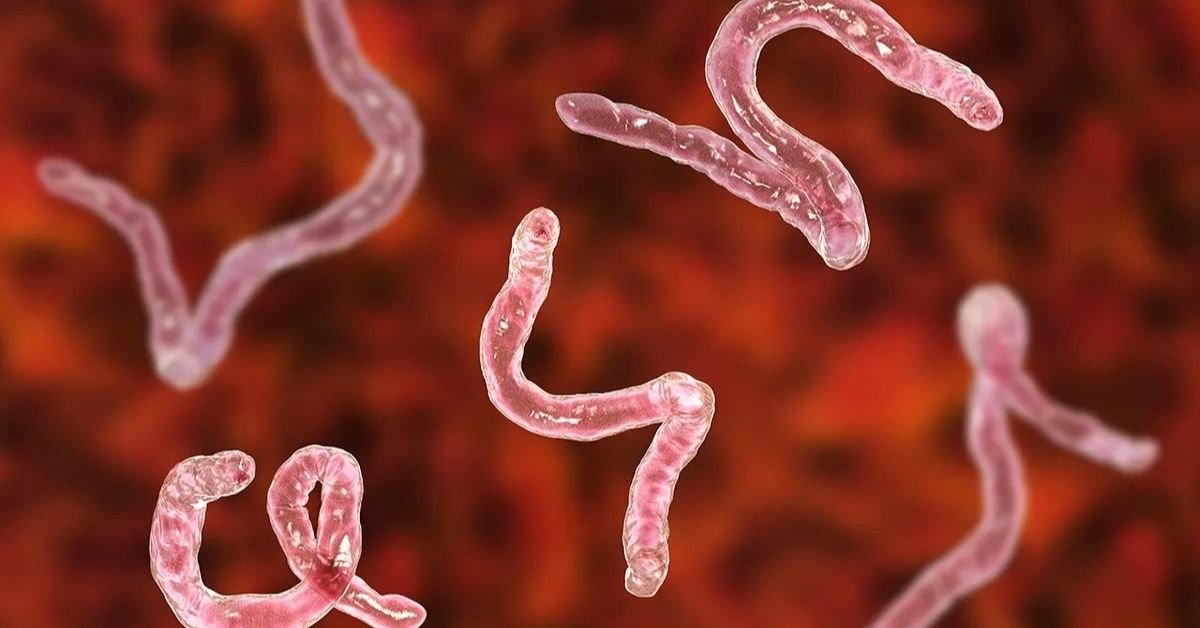 foods that kill parasites in human